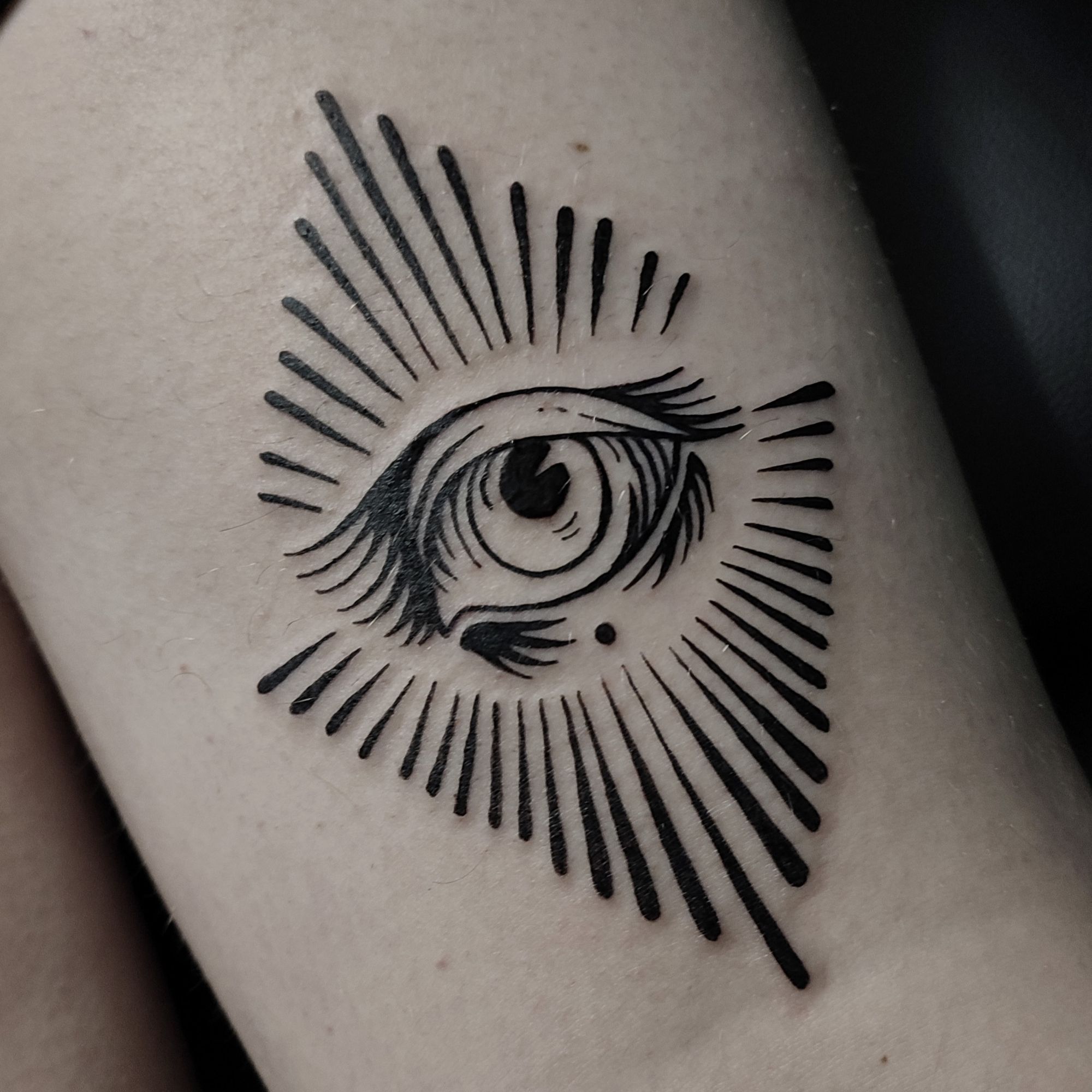 Eye